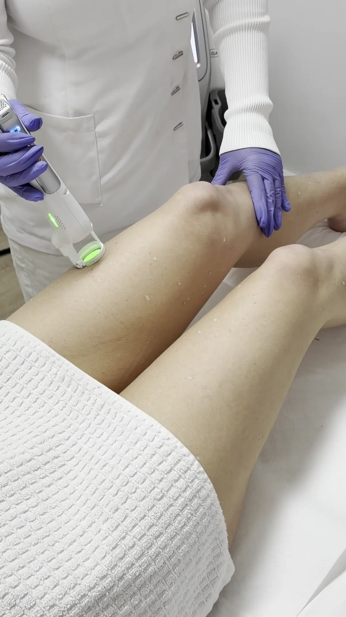 Laser-Haarentfernung am Bein im Studio von Laser Clinic Hamburg